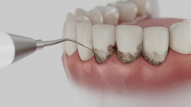 Trusted Dental Implants service in Helena-West Helena, AR - Dentist Open Now